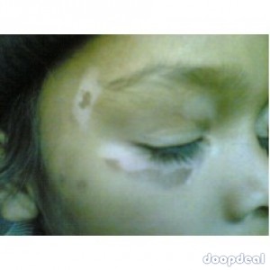 AROGYAM PURE HERBS KIT FOR VITILIGO