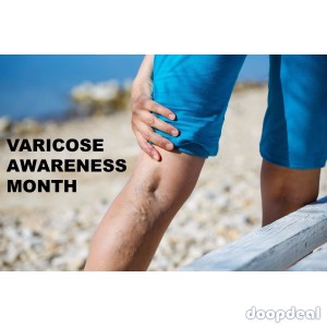 Varicose Veins Treatments in 1 Hour