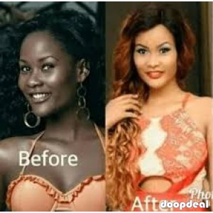 SKIN LIGHTENING CREAM IN VEREENIGING +27788756444 Skin Lightening oil in Johannesburg, Pretoria,Vosloorus, Hammanskraal, Benoni, Springs, Alberton, Krugersdorp, Meyerton, Heidelberg, Randfontein, Carletonville, Kagiso, Westonaria